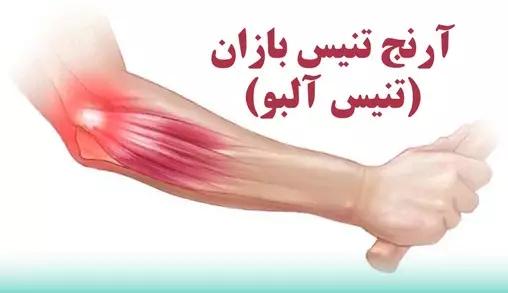 تنیس البو (Tennis Elbow) یا اپی‌ کوندیلیت خارجی،علائم، علل و درمان‌ های موثر