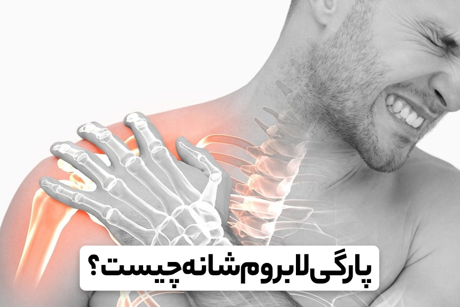 پارگی لبروم شانه، علائم، علل و روش‌ های درمان